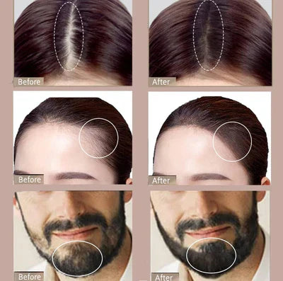 😍 Bunee - Tintura de Cabello ✔️ (Cubre Todas las Canas) 😍 🚛 PAGO CONTRA ENTREGA 🚛 ⏰ ENVIO-GRATÍS ⏰